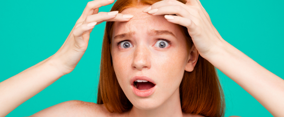 Rutina de skincare para piel seca con acné: cómo equilibrar la hidratación y el control de imperfecciones