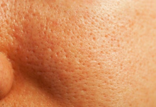 Cómo reducir los poros abiertos a los 50 años: consejos, cuidados y productos efectivos de Biovous
