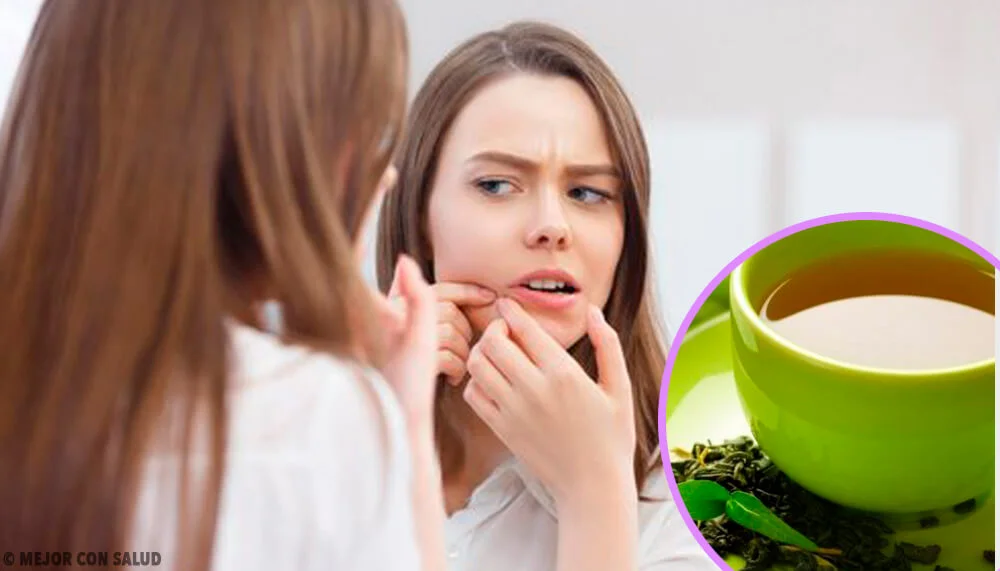 Cómo usar el té verde para cuidar la piel de tu rostro
