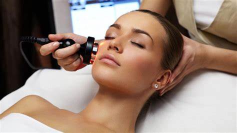 ¿Qué es la radiofrecuencia facial y para qué sirve?